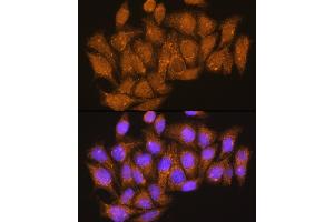 Immunofluorescence analysis of HeLa cells using V1E1 Rabbit pAb (ABIN1678795, ABIN3018056, ABIN3018057 and ABIN6220346) at dilution of 1:100. (ATP6V1E1 antibody  (AA 77-226))