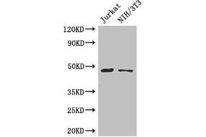Western Blot Positive WB detected in: Jurkat whole cell lysate, NIH/3T3 whole cell lysate All lanes: SGK1 antibody at 3 μg/mL Secondary Goat polyclonal to rabbit IgG at 1/50000 dilution Predicted band size: 49, 60, 51, 48, 53 kDa Observed band size: 49 kDa (SGK1 antibody  (AA 247-406))