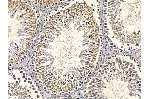 ABIN6260157 and ABIN6277857 at 1/100 staining rat testis tissue by IHC-P. (AurB/C antibody  (N-Term))