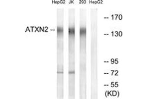 Western blot analysis of extracts from HepG2/Jurkat/293 cells, using ATXN2 Antibody.