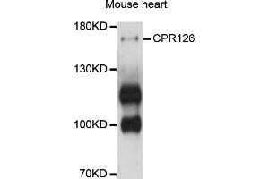 Western blot analysis of extracts of mouse heart, using GPR126 antibody (ABIN4903810) at 1:1000 dilution. (G Protein-Coupled Receptor 126 antibody)