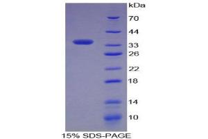 SDS-PAGE (SDS) image for Complement Component 5a (C5a) (AA 678-751) protein (GST tag) (ABIN1980727)