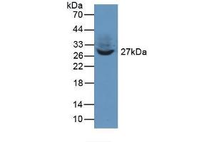 Western blot analysis of recombinant Human TWF1. (TWF1 antibody  (AA 1-252))