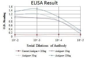 Red: Control Antigen (100 ng), Purple: Antigen (10 ng), Green: Antigen (50 ng), Blue: Antigen (100 ng), (ATM antibody)