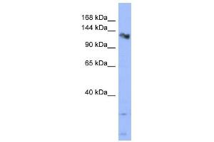 CHERP antibody used at 1 ug/ml to detect target protein. (CHERP antibody  (Middle Region))