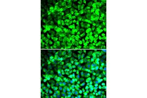 Immunofluorescence analysis of U2OS cells using EIF5 antibody (ABIN5973954). (EIF5 antibody)