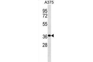 Western Blotting (WB) image for anti-Non-SMC Element 1 Homolog (NSMCE1) antibody (ABIN3000163) (NSMCE1 antibody)