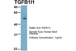 Western Blotting (WB) image for anti-Transforming Growth Factor beta 1 Induced Transcript 1 (TGFB1I1) (Middle Region) antibody (ABIN2777947)