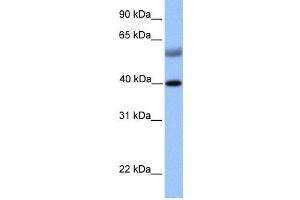 Western Blotting (WB) image for anti-ISL LIM Homeobox 1 (ISL1) antibody (ABIN2457943) (ISL1 antibody)