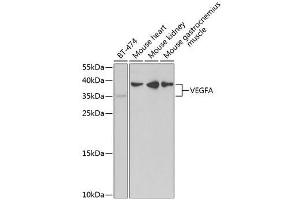 Western Blot Analysis using ABIN6150086 (VEGFA antibody  (AA 1-147))
