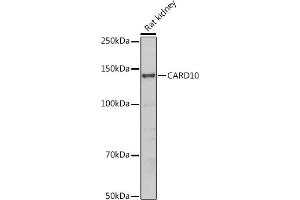 Western blot analysis of extracts of Rat kidney, using C antibody (ABIN6127549, ABIN6137937, ABIN6137938 and ABIN6223226) at 1:500 dilution. (CARD10 antibody  (AA 863-1032))