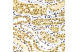 Immunohistochemistry (IHC) image for anti-ELAV (Embryonic Lethal, Abnormal Vision, Drosophila)-Like 1 (Hu Antigen R) (ELAVL1) (AA 1-326) antibody (ABIN3022231)