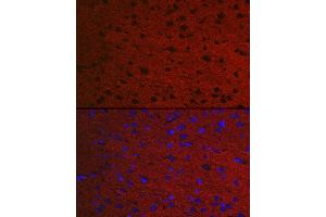 Immunofluorescence analysis of Rat brain using RA antibody (ABIN7269809) at dilution of 1:50. (RAB3A antibody  (AA 100-200))