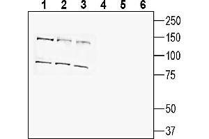 Western blot analysis of human HepG2 hepatocellular carcinoma cell line lysate (lanes 1 and 4), human  breast adenocarcinoma cell line lysate (lanes 2 and 5) and human  monocytic leukemia cell line lysate (lanes 3 and 6):1-3.