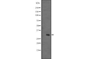 Western blot analysis of IGFBPL1 expression in Human fetal liver lysate ,The lane on the left is treated with the antigen-specific peptide. (IGFBPL1 antibody  (Internal Region))