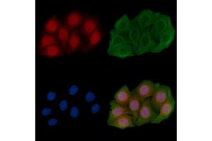 ABIN6261789 and ABIN6266775 staining Hela cells(45 min of heat-shock) by IF/ICC. (FOXH1 antibody  (Internal Region))