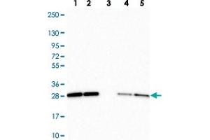 Western blot analysis of Lane 1: Human cell line RT-4 Lane 2: Human cell line U-251MG sp Lane 3: Human plasma (IgG/HSA depleted) Lane 4: Human liver tissue Lane 5: Human tonsil tissue with RBL1 polyclonal antibody  at 1:250-1:500 dilution.