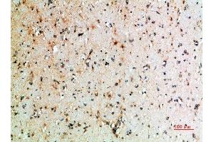 Immunohistochemical analysis of paraffin-embedded human-brain, antibody was diluted at 1:200 (CTLA4 antibody  (AA 41-90))