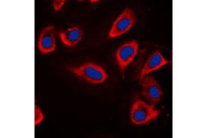 Immunofluorescent analysis of Alpha-adducin staining in HeLa cells. (alpha Adducin antibody  (Center))