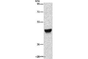 Western blot analysis of Human esophagus cancer tissue, using KRT13 Polyclonal Antibody at dilution of 1:500 (Cytokeratin 13 antibody)