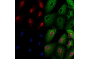 ABIN6262731 and ABIN6266953 staining  cells by IF/ICC. (KAD6 antibody  (Internal Region))