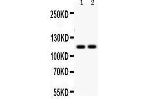Western Blotting (WB) image for anti-ATPase, Ca++ Transporting, Ubiquitous (ATP2A3) (AA 1-30), (N-Term) antibody (ABIN3043794) (ATP2A3 antibody  (N-Term))