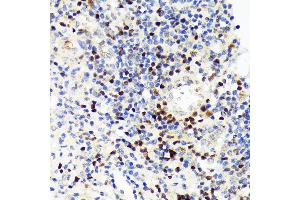Immunohistochemistry of paraffin-embedded human appendix using P Rabbit mAb (ABIN7269154) at dilution of 1:100 (40x lens). (PAX5 antibody)