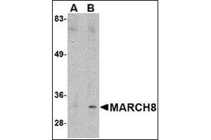 Western blot analysis of MARCH8 in HeLa cell lysate with MARCH8 antibody at (A) 0. (MARCH8 antibody  (C-Term))
