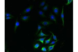 Immunofluorescent analysis of A549 cells using ABIN7170170 at dilution of 1:100 and Alexa Fluor 488-congugated AffiniPure Goat Anti-Rabbit IgG(H+L) (SLC23A1 antibody  (AA 173-259))