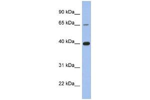 WB Suggested Anti-ESR1 Antibody Titration:  0. (Estrogen Receptor alpha antibody  (C-Term))
