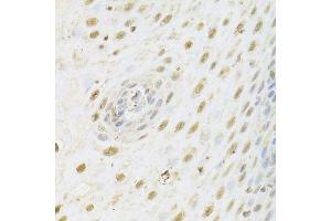 Immunohistochemistry of paraffin-embedded human esophagus using HDAC3 Antibody. (HDAC3 antibody  (AA 299-428))