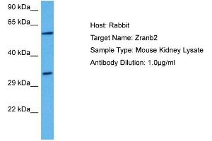 Host: Mouse Target Name: ZRANB2 Sample Tissue: Mouse Kidney Antibody Dilution: 1ug/ml (EIF5 antibody  (C-Term))