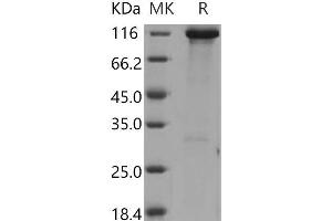 Western Blotting (WB) image for Hexokinase 3 (White Cell) (HK3) protein (GST tag,His tag) (ABIN7196087) (HK3 Protein (GST tag,His tag))