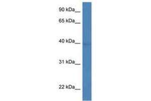 Image no. 1 for anti-ADP-Ribosylation Factor Interacting Protein 2 (ARFIP2) (AA 26-75) antibody (ABIN6746050) (ARFIP2 antibody  (AA 26-75))