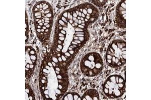 Immunohistochemical staining of human rectum with CDAN1 polyclonal antibody  shows strong cytoplasmic and membranous positivity in glandular cells. (Codanin 1 (CDNA1) antibody)