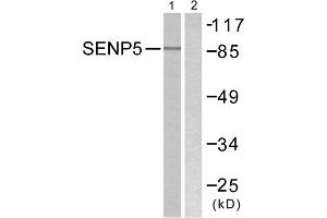 Western Blotting (WB) image for anti-SUMO1/sentrin Specific Peptidase 5 (SENP5) (C-Term) antibody (ABIN1848844) (SENP5 antibody  (C-Term))