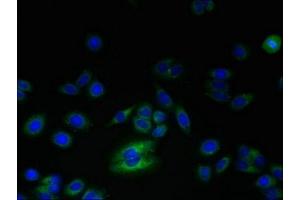 Immunofluorescent analysis of HepG2 cells using ABIN7168256 at dilution of 1:100 and Alexa Fluor 488-congugated AffiniPure Goat Anti-Rabbit IgG(H+L) (RNF24 antibody  (AA 45-148))