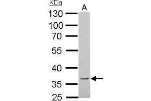 WB Image CD272 antibody detects BTLA protein by Western blot analysis. (BTLA antibody)