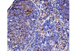 IHC analysis of Cd38 using anti-Cd38 antibody (ABIN7602864). (CD38 antibody  (C-Term))