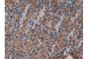 Detection of ND5 in Rat Stomach Tissue using Polyclonal Antibody to NADH Dehydrogenase 5 (ND5) (MT-ND5 antibody  (AA 425-562))