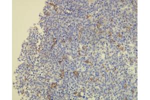 Immunohistochemistry (IHC) image for anti-CD163 (CD163) (AA 134-148), (N-Term) antibody (ABIN870408) (CD163 antibody  (N-Term))