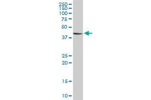 STYK1 MaxPab rabbit polyclonal antibody. (STYK1 antibody  (AA 1-422))