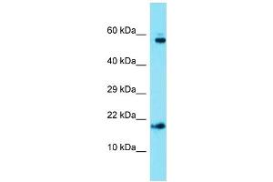 Host: Rabbit  Target Name: Ap1s1  Sample Tissue: Mouse Heart lysates  Antibody Dilution: 1. (AP1S1 antibody  (C-Term))