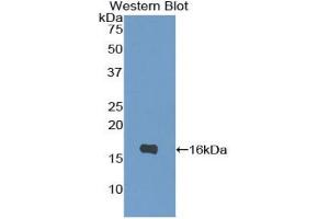 Western blot analysis of the recombinant protein. (IL-4 antibody  (AA 25-133))