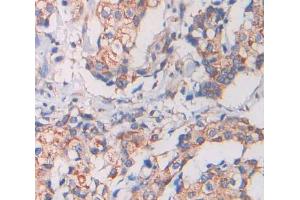 Used in DAB staining on fromalin fixed paraffin- embedded Kidney tissue (KEL antibody  (AA 128-332))