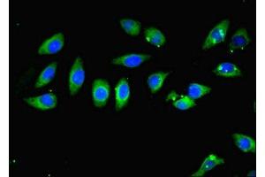 Immunofluorescent analysis of A549 cells using ABIN7146905 at dilution of 1:100 and Alexa Fluor 488-congugated AffiniPure Goat Anti-Rabbit IgG(H+L) (CARD1 (AA 863-1032) antibody)