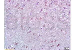 Formalin-fixed and paraffin embedded rat brain tissue labeled with Anti-Lingo-1 Polyclonal Antibody, Unconjugated (ABIN738801) at 1:200 followed by conjugation to the secondary antibody and DAB staining (LINGO1 antibody  (AA 521-620))