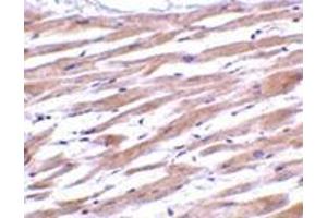 Immunohistochemistry of UNG1 in human heart tissue with this product at 2 μg/ml. (UNG antibody  (C-Term))