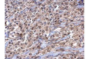 Immunohistochemistry (IHC) image for anti-Importin 7 (IPO7) (C-Term) antibody (ABIN2856366)