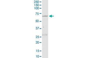 NLK monoclonal antibody (M02), clone 2B11. (Nemo-Like Kinase antibody  (AA 416-515))